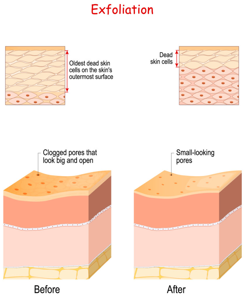 Why are my feet itchy, how to stop itchy feet