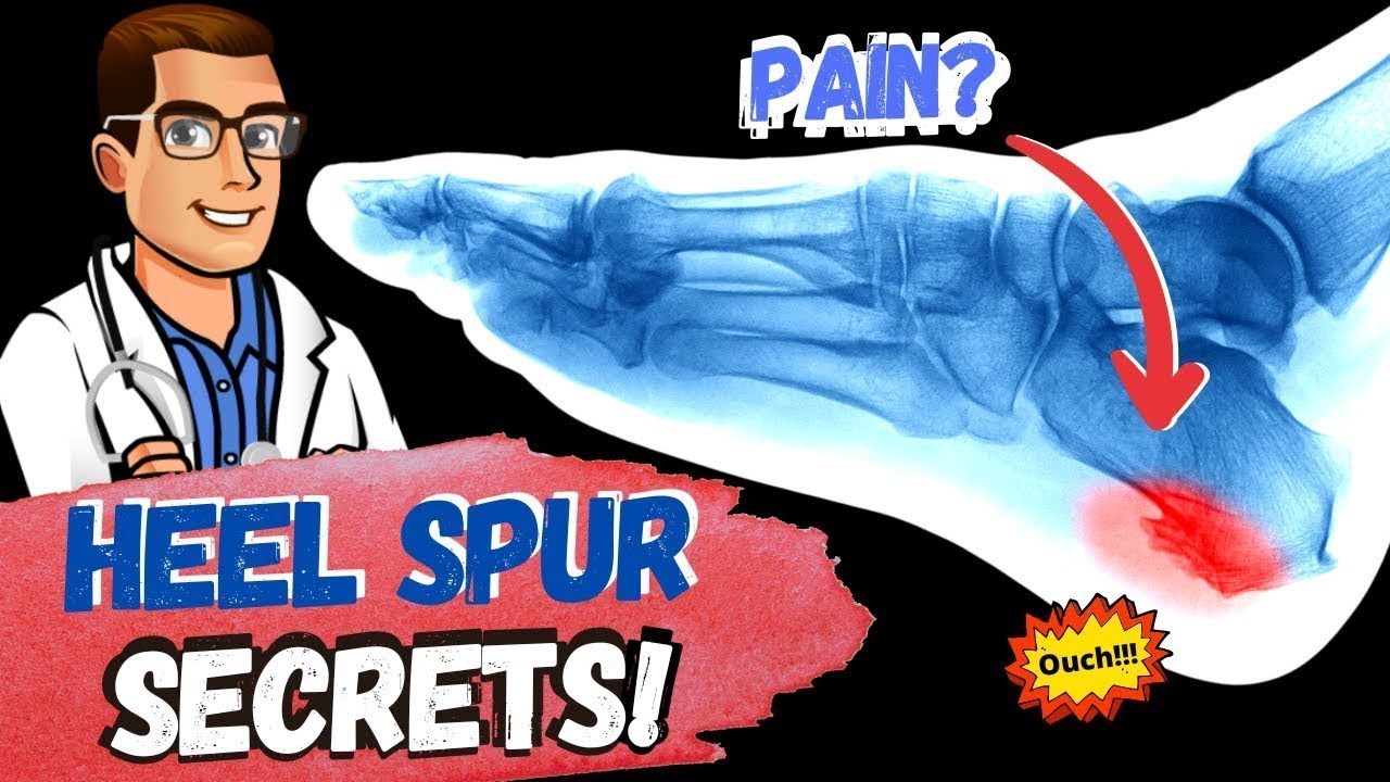 heel spur injection