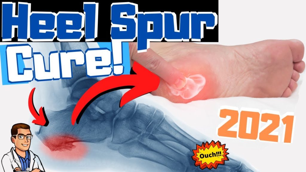 Heel Spur injection, Cortisone heel spur injection