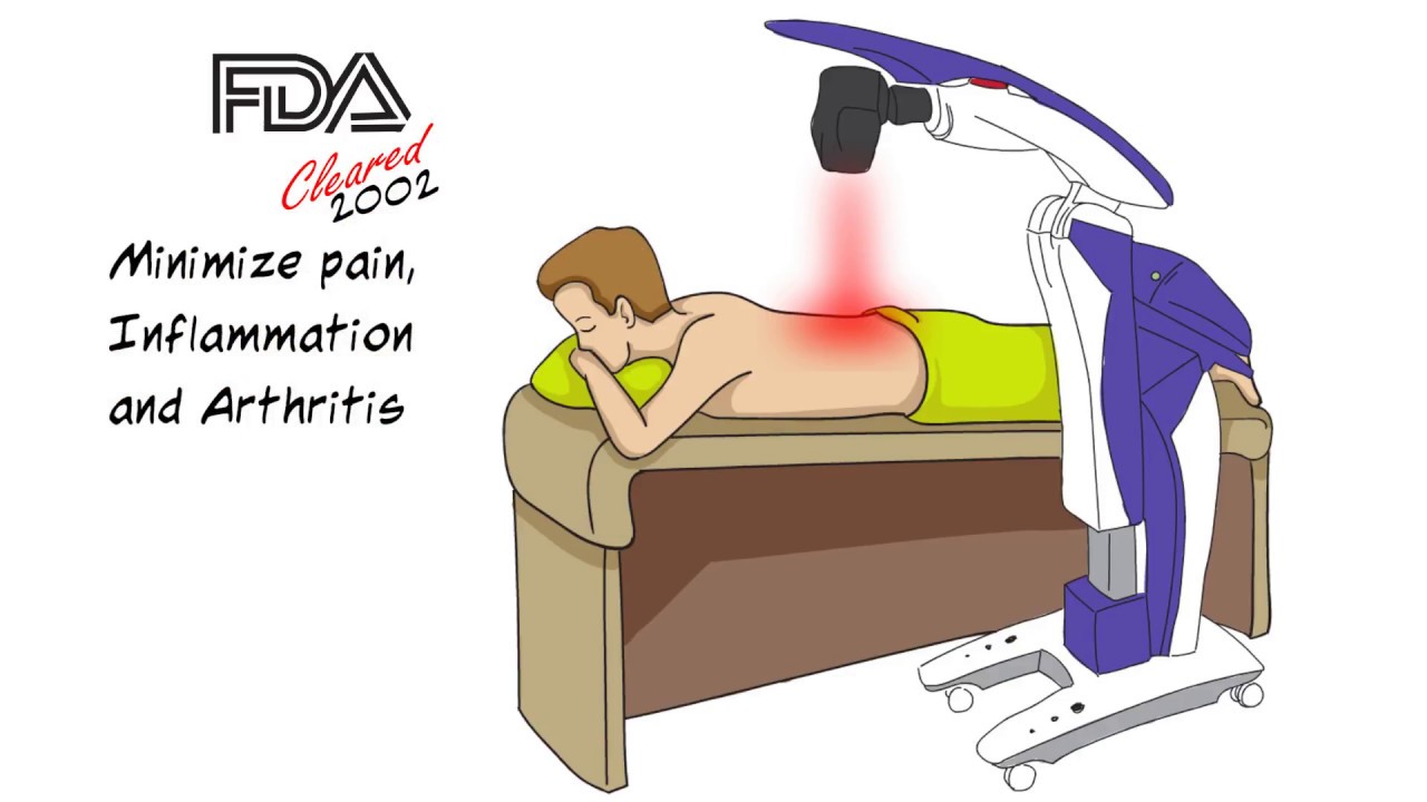 mls laser therapy 3