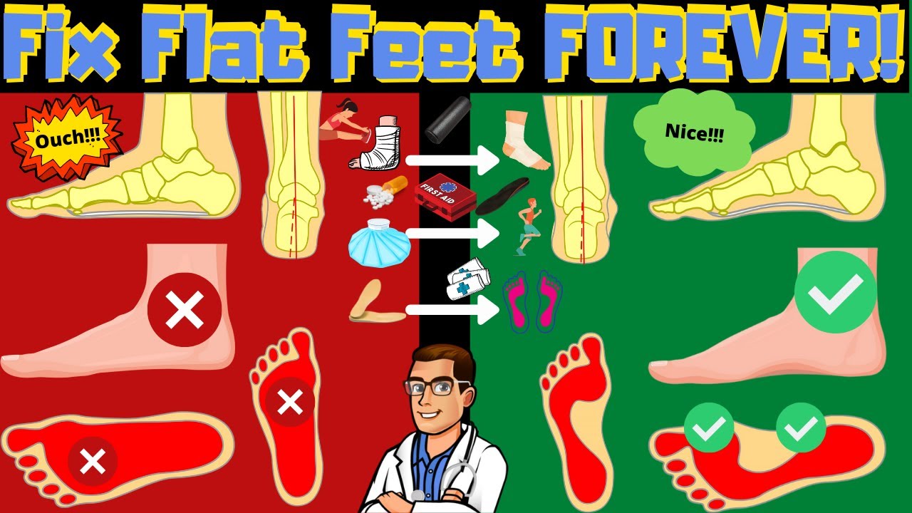 overpronation vs supination how to fix flat feet pain forever