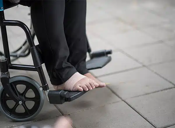 Close-up of an elderly patient&rsquo;s foot in a wheelchair with a medical compression wrap around the ankle, illustrating the management of chronic foot pain or injury in geriatric podiatric care.
