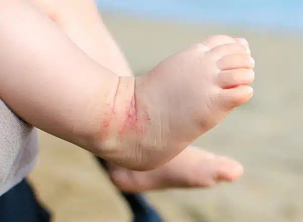 A close-up of a mother&rsquo;s hands gently holding and massaging the bottom of her young child's bare foot.