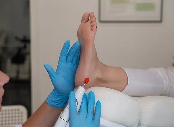 A podologist wearing blue gloves uses an electric filing device with a red attachment to perform a medical pedicure on a patient's heel.
