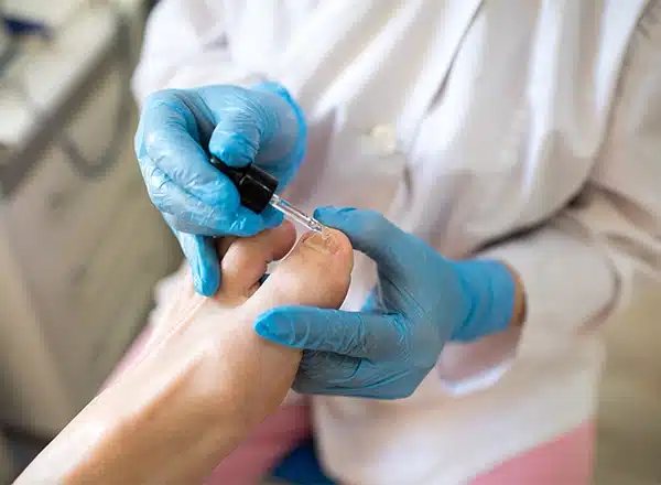 A technician in blue gloves using a dropper to apply a clear liquid treatment to a patient's toenail during a professional pedicure.