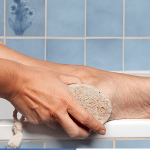 how to remove a callus