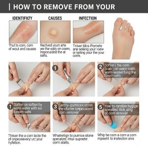 how to remove a corn from your foot