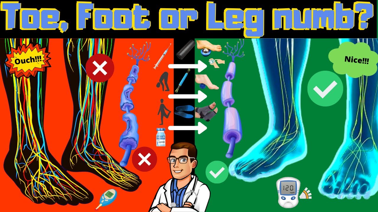 Numb toes, legs or feet