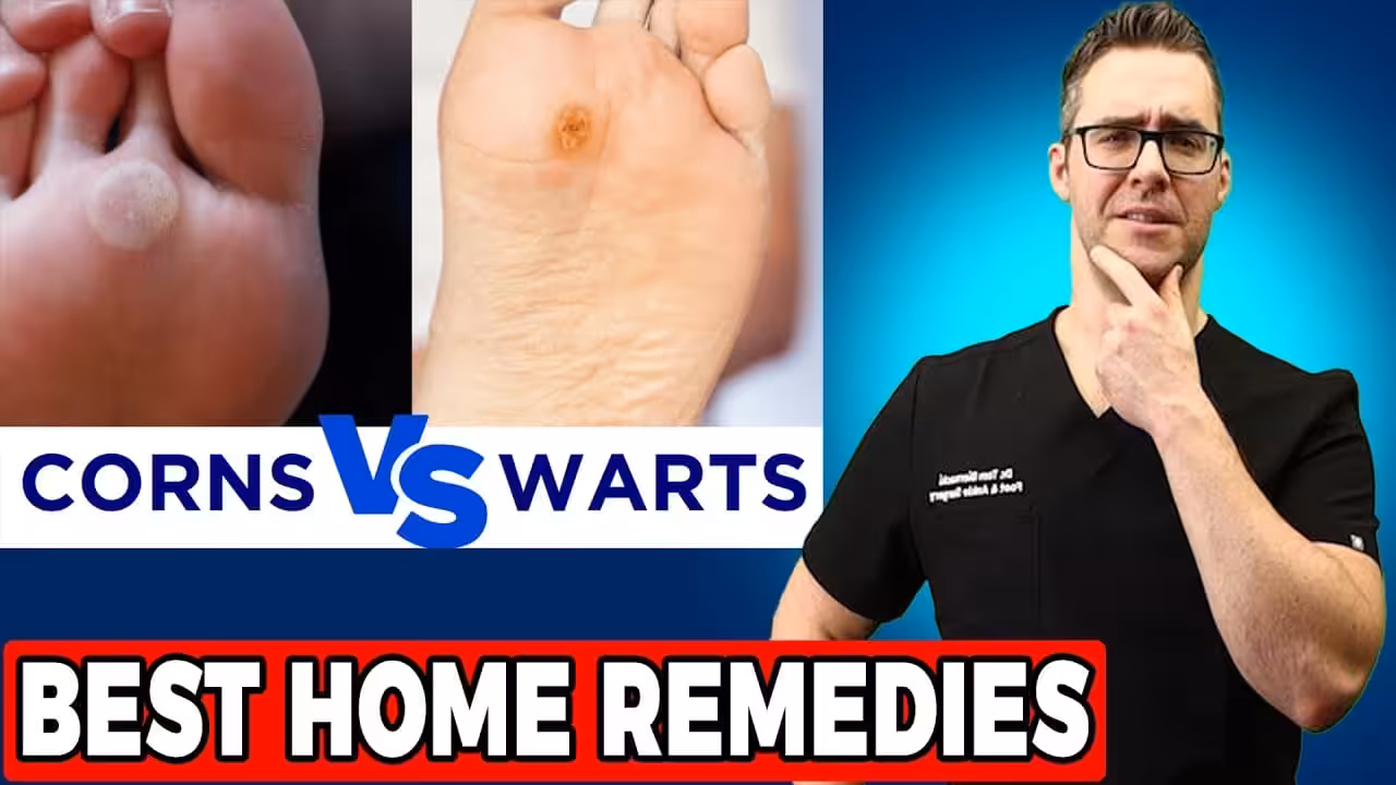 Podiatrist callus removal