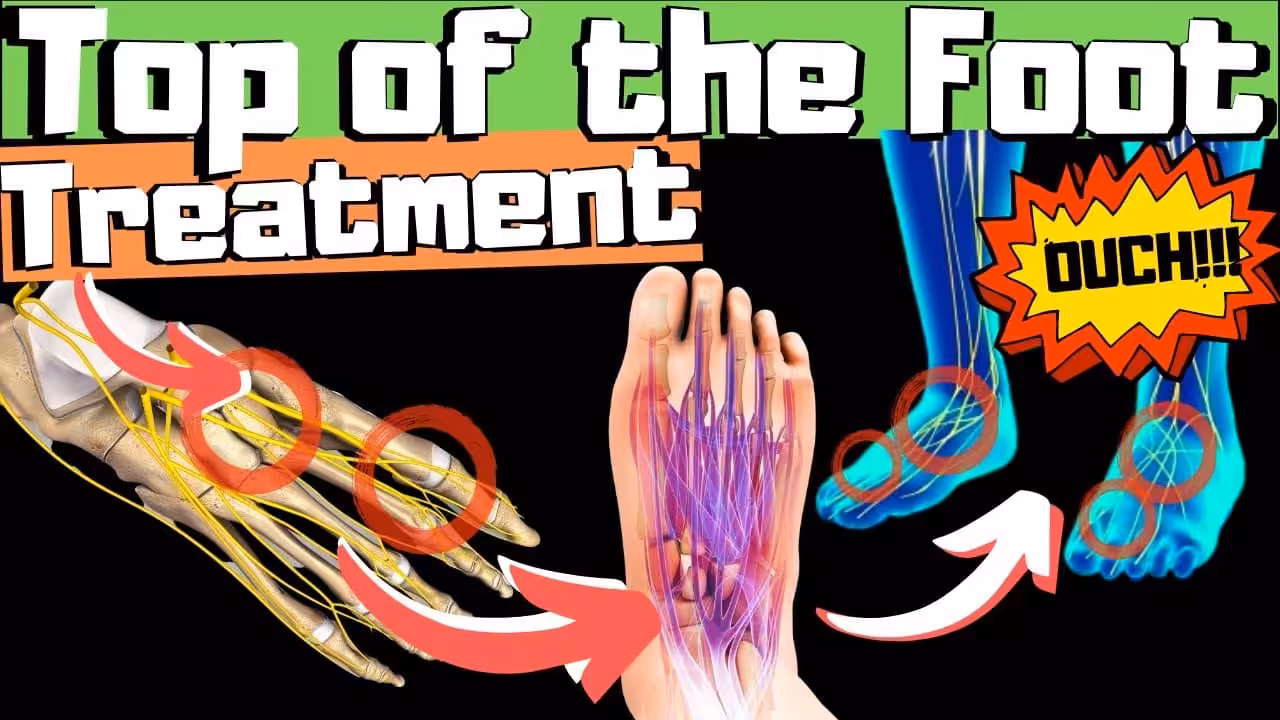 Swollen Top of Foot or Top of Foot Tendonitis