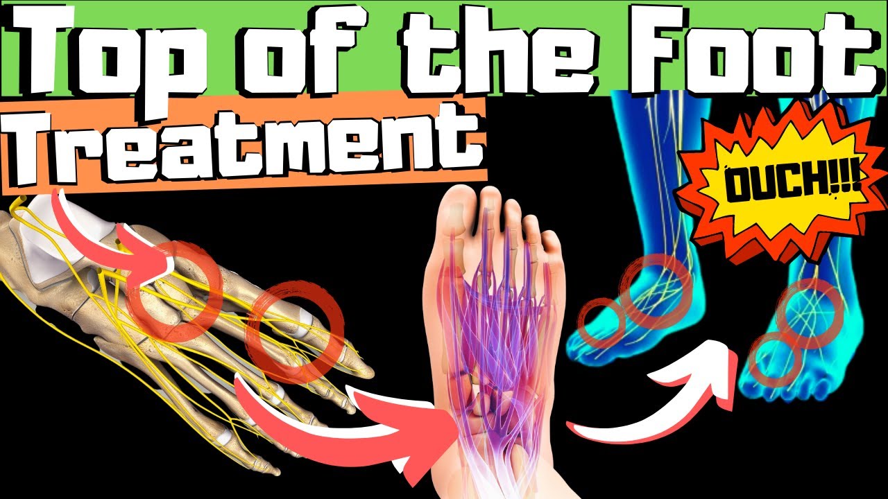 swollen top of foot or top of foot tendonitis fix top of foot pain