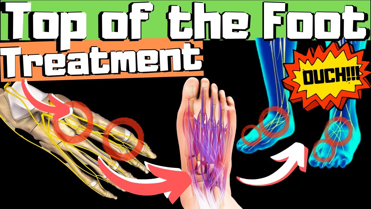 swollen top of foot or top of foot tendonitis fix top of foot pain