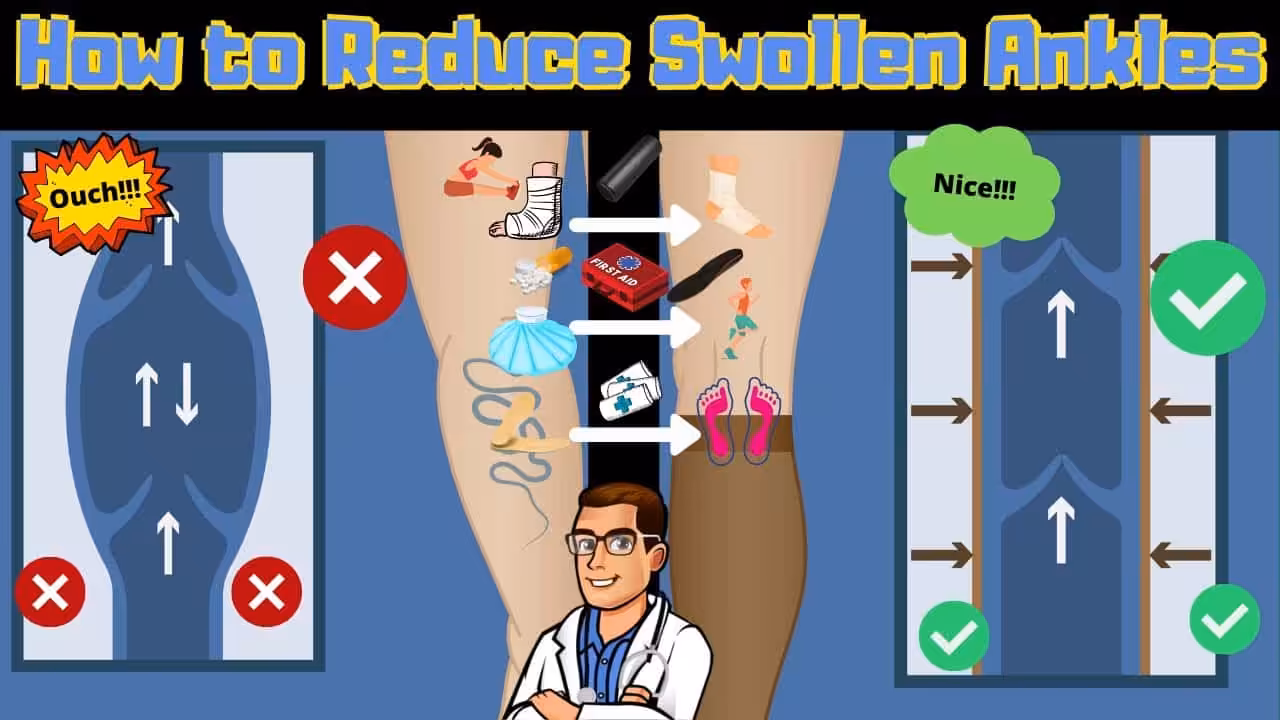 How To Get Rid Of Swollen Ankles & Swollen Legs Fast [Causes & Fixes] | Balance Foot & Ankle