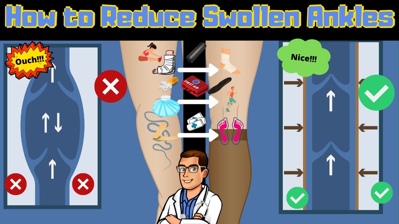how to get rid of swollen ankles swollen legs fast causes