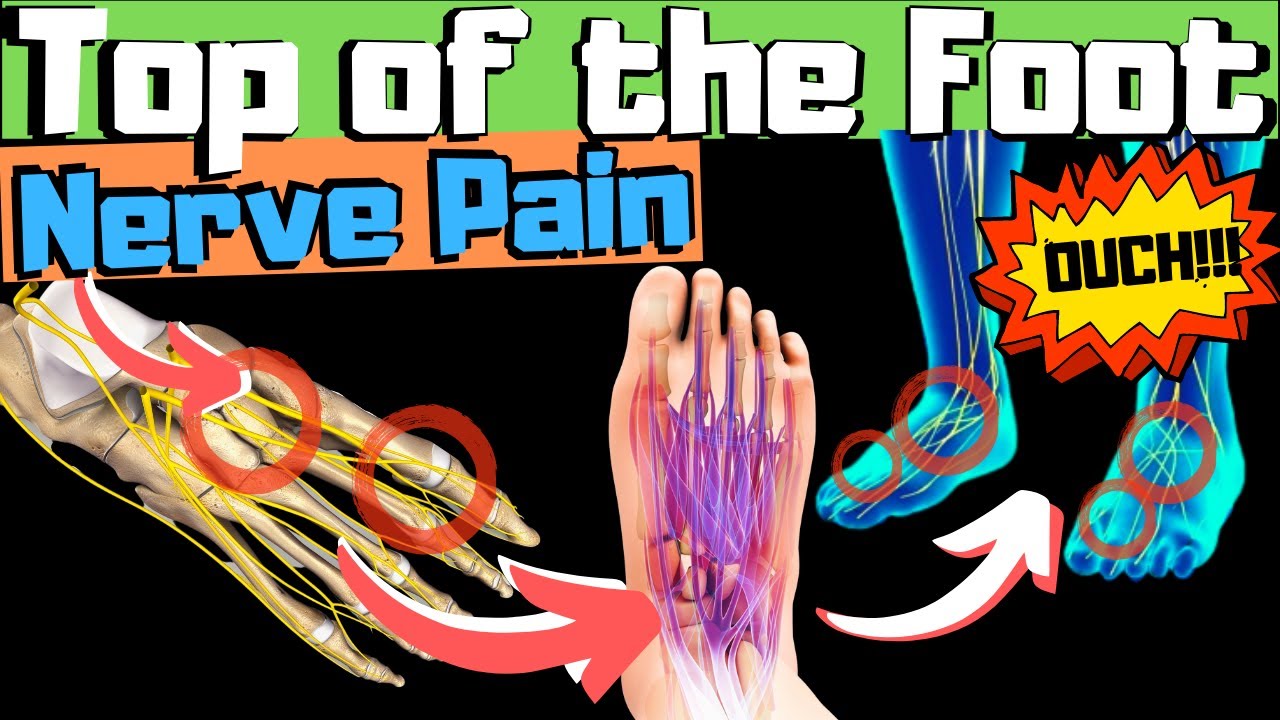 sharp burning tingling top of foot pain fix your nerve pain