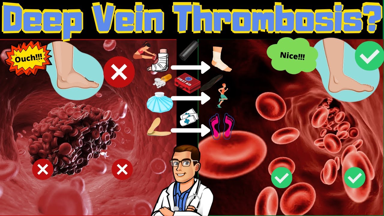 A spider vein & varicose vein can lead to a blood clot, this can become very dangerous if left untreated.
