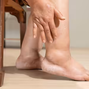 Lymphedema Treatment