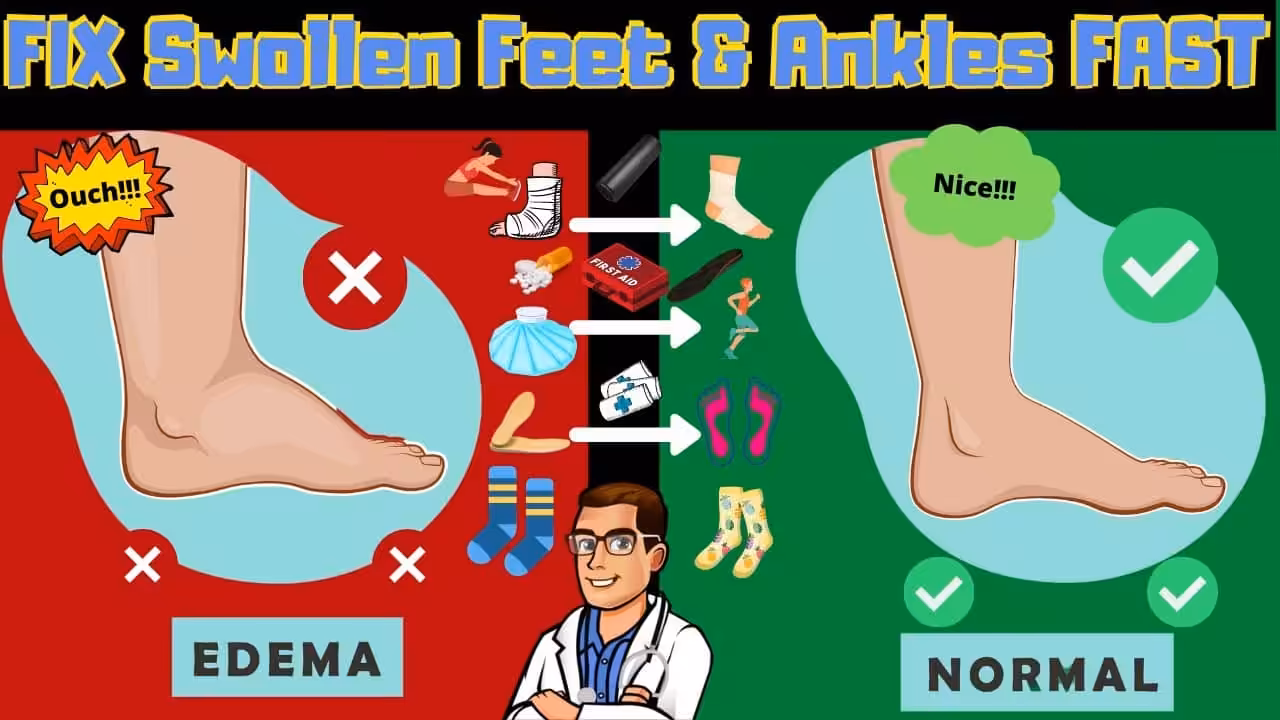 Lymphedema Treatment