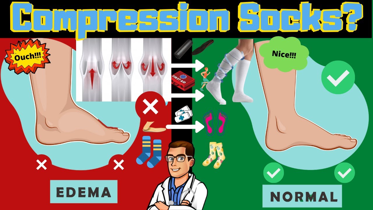 are compression socks worth it how to fix swollen ankles feet