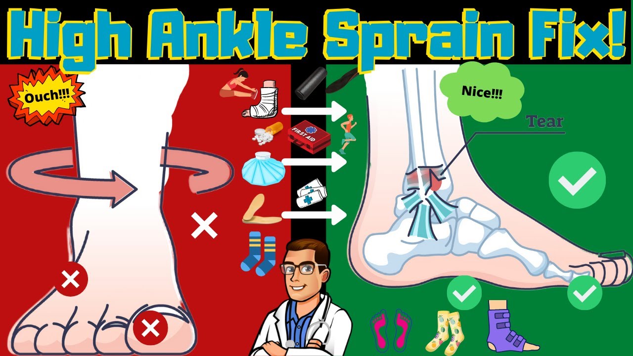 high ankle sprain syndesmotic ankle sprain test recovery time