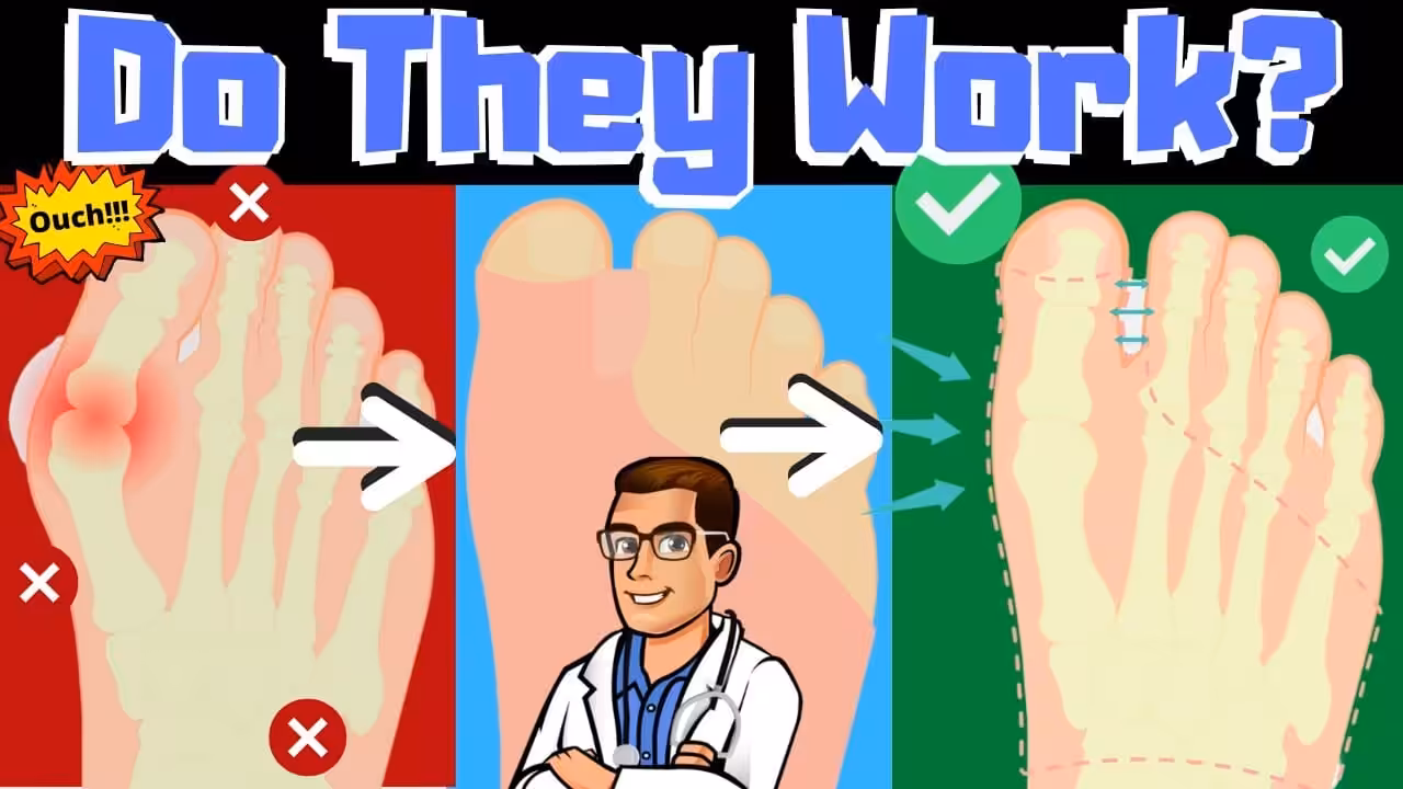 Do Bunion Correctors Work How To Shrink Bunions Naturally 2 2 - Balance Foot & Ankle