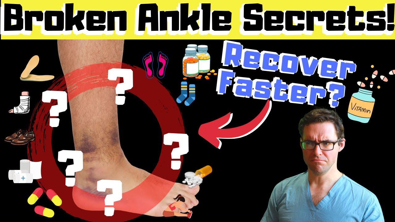 get a fast broken ankle fracture recovery doctor secrets revealed
