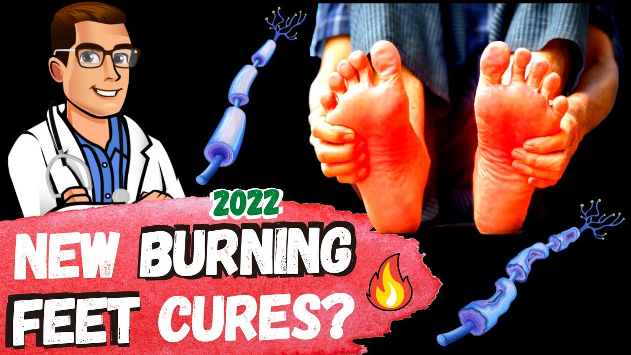top 7 burning feet causes treatments 2 new 2022 cures