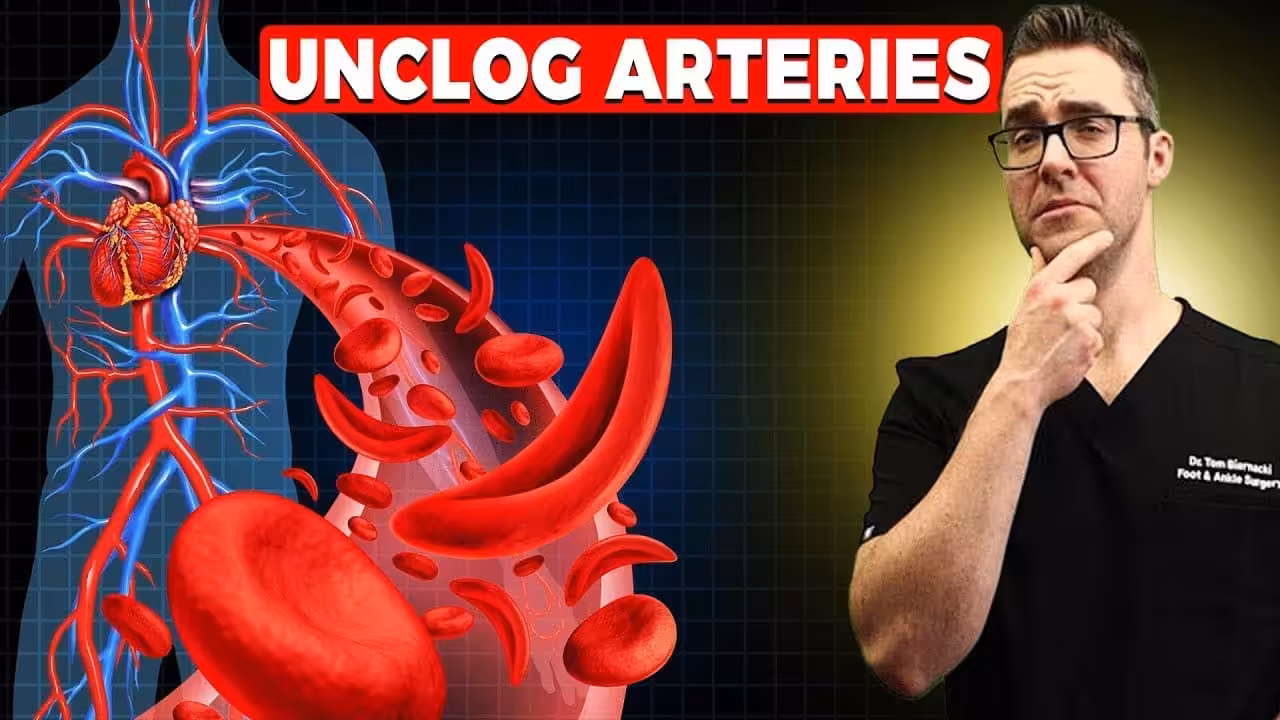 Worst Foods For Clogged Arteries - Balance Foot & Ankle