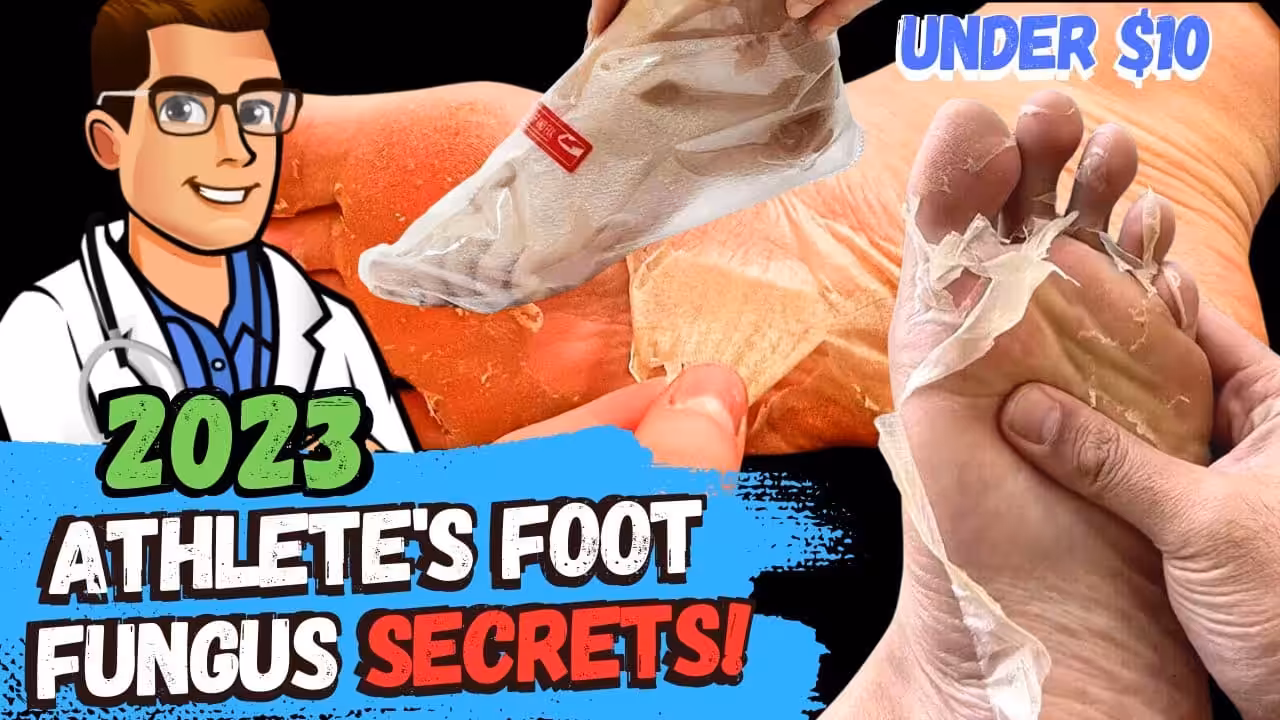 How To Cure Athletes Foot Fungus Fast [Home Remedies + 3 Big Secrets] | Balance Foot & Ankle