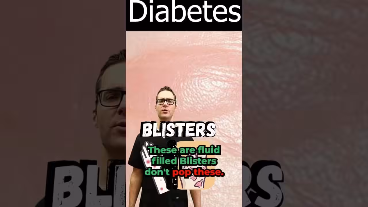 Blister On Foot, Toe Or Between Toes? [Diabetic Skin Symptoms] | Balance Foot & Ankle