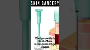 Early Stage Skin Cancer Signs [Skin Cancer Biopsy & Moh’S Surgery] | Balance Foot & Ankle