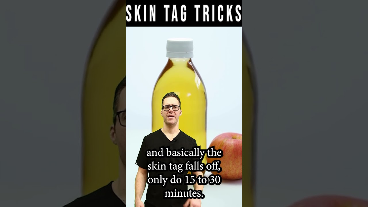 how to get rid of skin tags wart removal apple cider vinegar