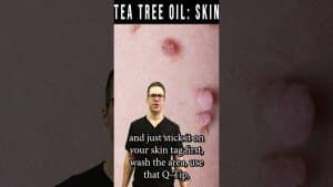 Skin Tag Removal & Wart Removal [Tea Tree Oil Natural Remedy] | Balance Foot & Ankle
