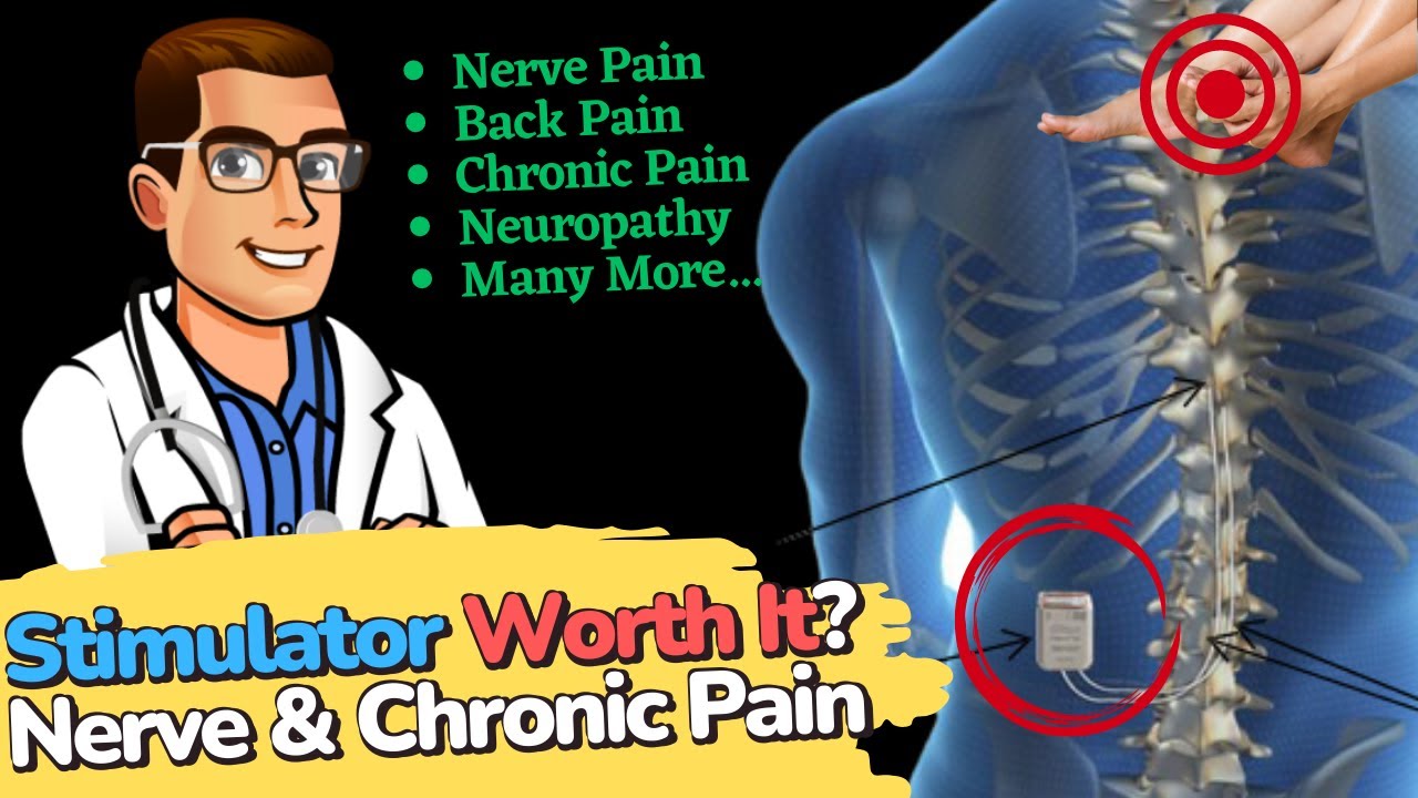 spinal cord stimulator for chronic pain neuropathy back pain