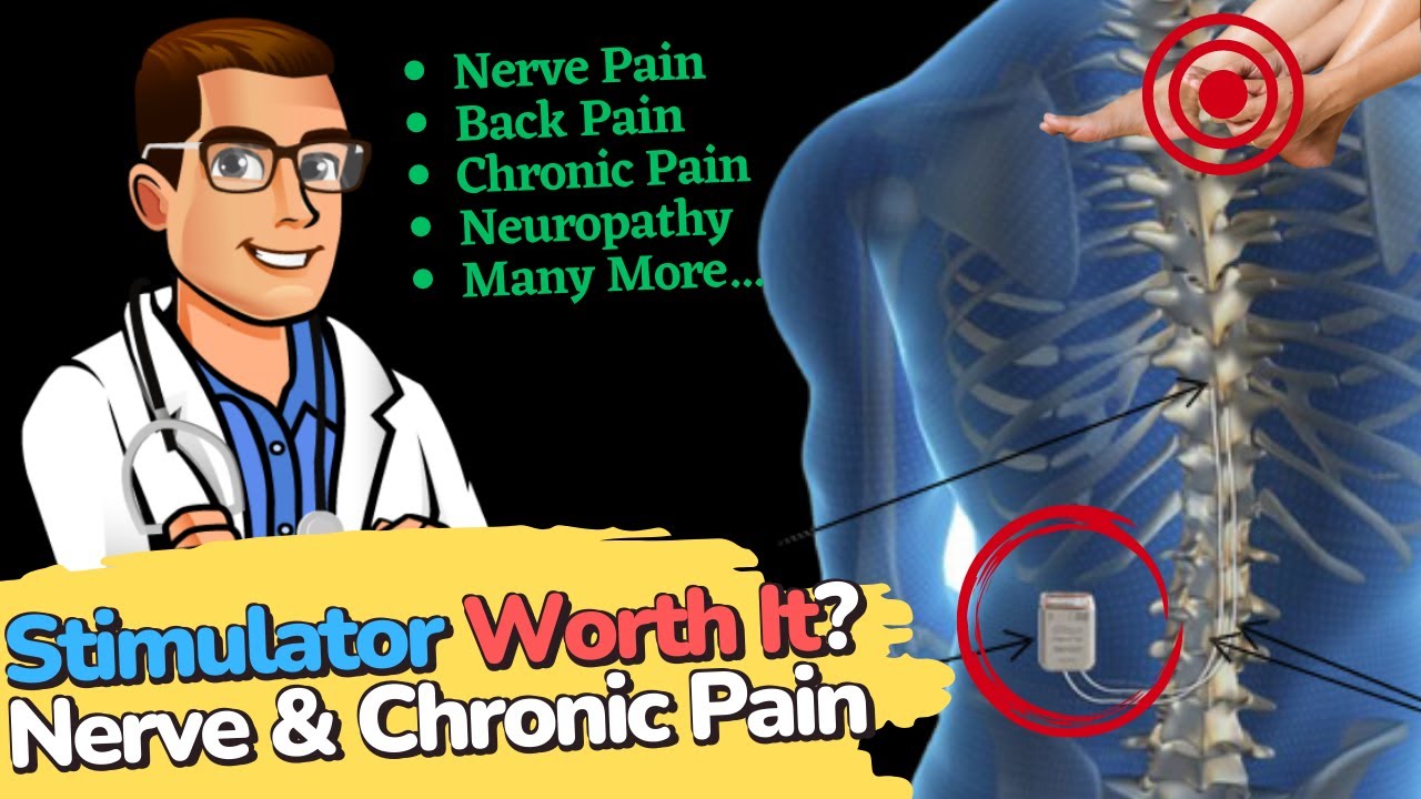spinal cord stimulator for chronic pain neuropathy back pain