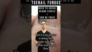 Toenail Fungus Treatment [What Kills Toenail Fungus Instantly?]