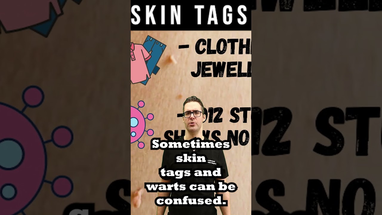 what causes skin tags what are skin tags
