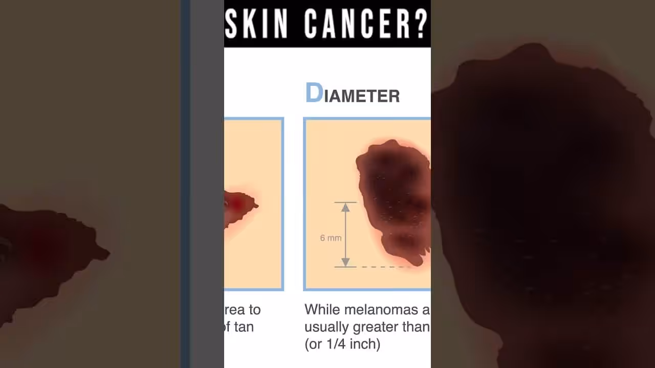 What Does Skin Cancer Look Like? [Symptoms, Pictures, Types] | Balance Foot & Ankle