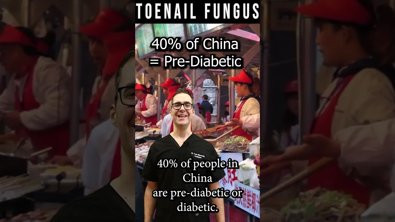 why is my toenail fungus not cure fix the real root causes