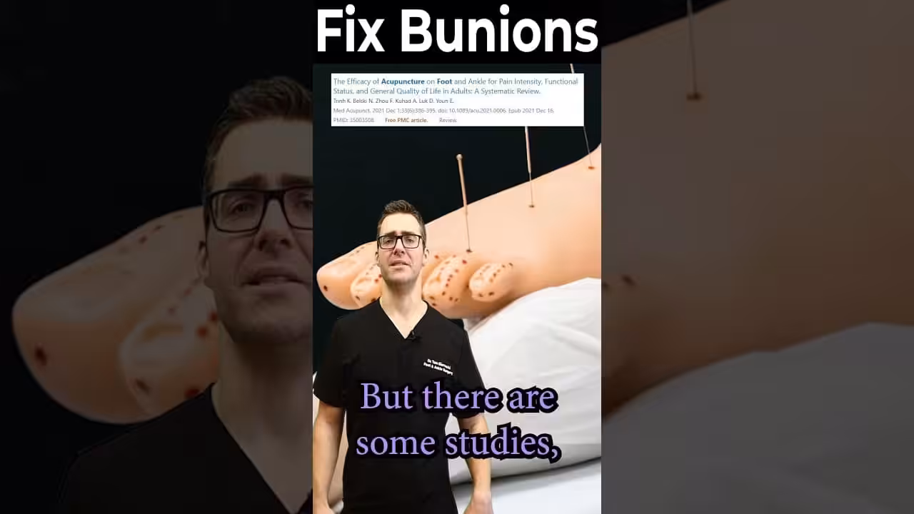 Acupuncture For Bunions Worth It How To Get Rid Of Bunions 3 - Balance Foot & Ankle