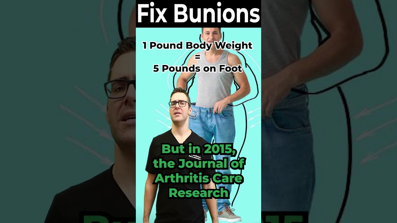 big toe joint pain relief bunion correction weight loss