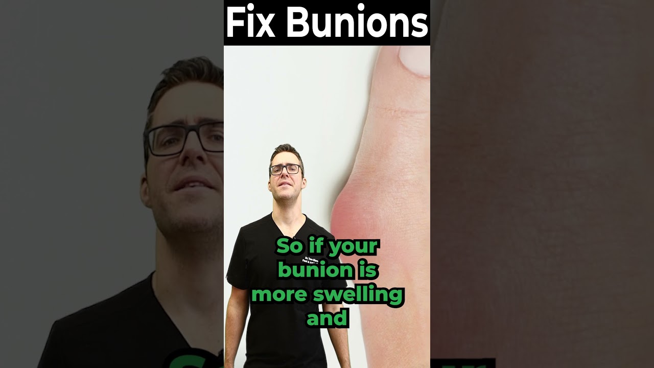 bunion pain relief with medication nsaids steroids creams
