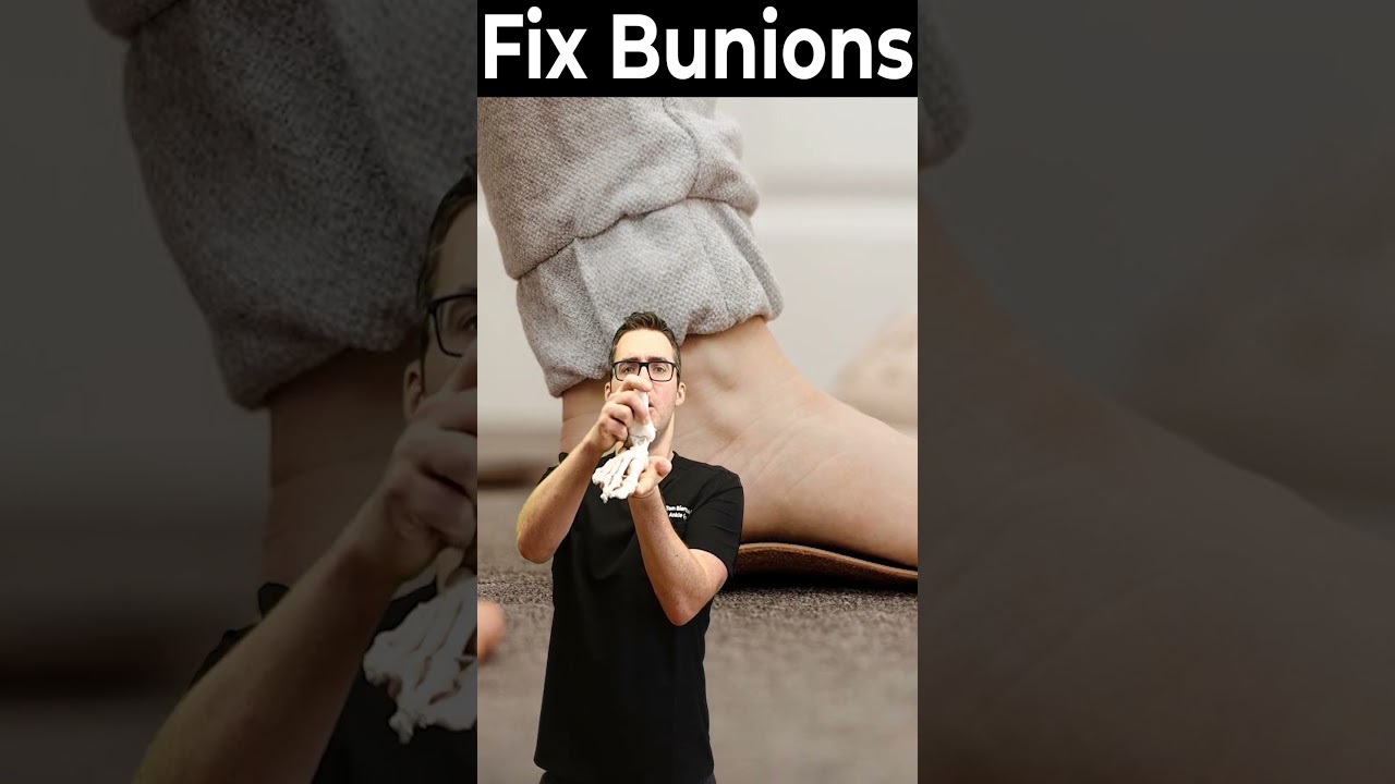 how to get rid of bunions best bunion corrector orthotics