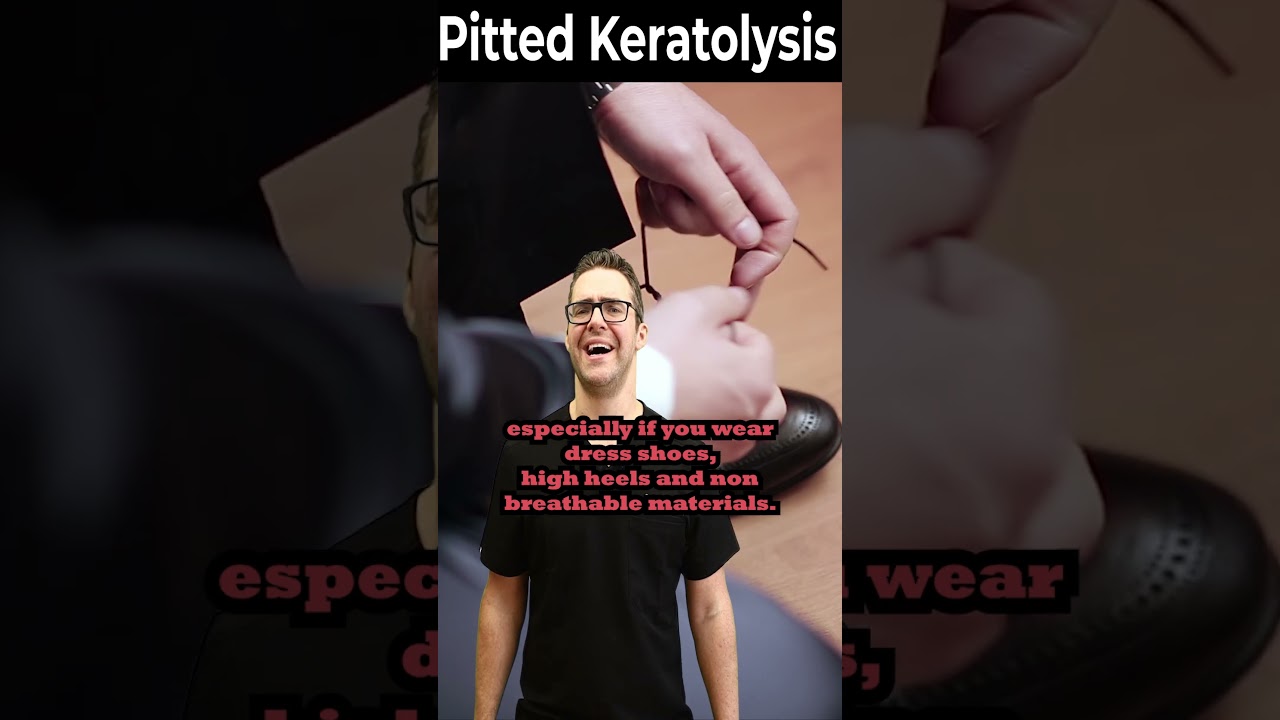 how to get rid of pitted keratolysis once for all