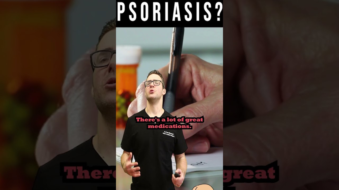 psoriasis treatment how to get rid of psoriasis fast