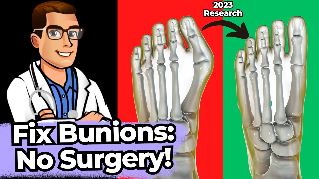 top 13 ways to shrink bunions naturally 1 huge secret