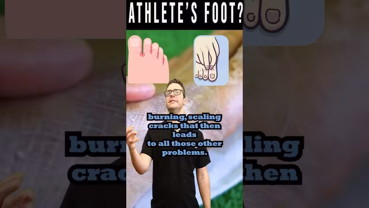 Athlete’S Foot Fungus: The Itchy, Scaly Truth! | Balance Foot & Ankle