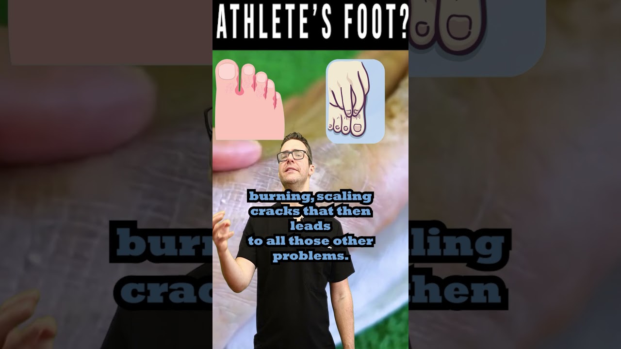 athlete s foot fungus the itchy scaly truth