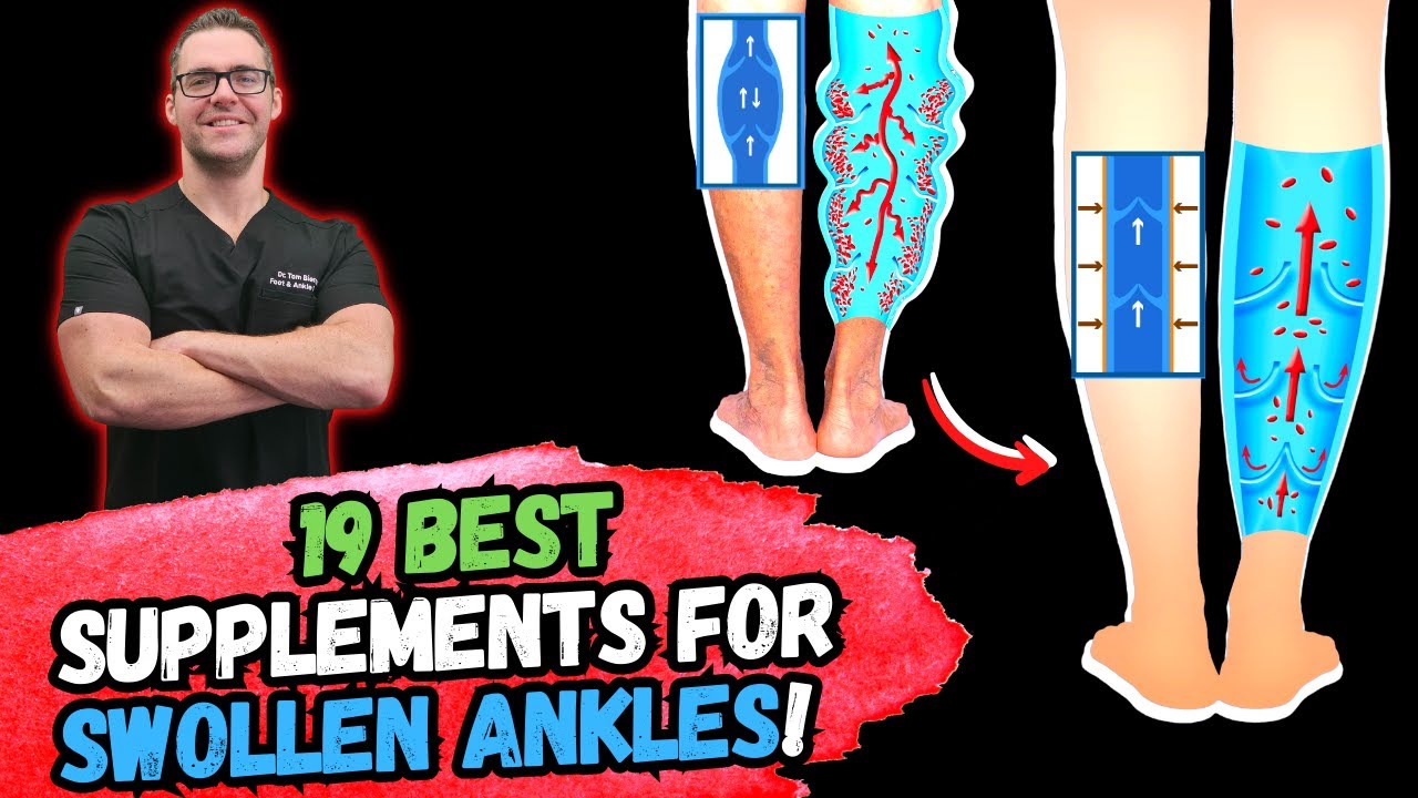 best 19 supplements to fix swollen feet ankles