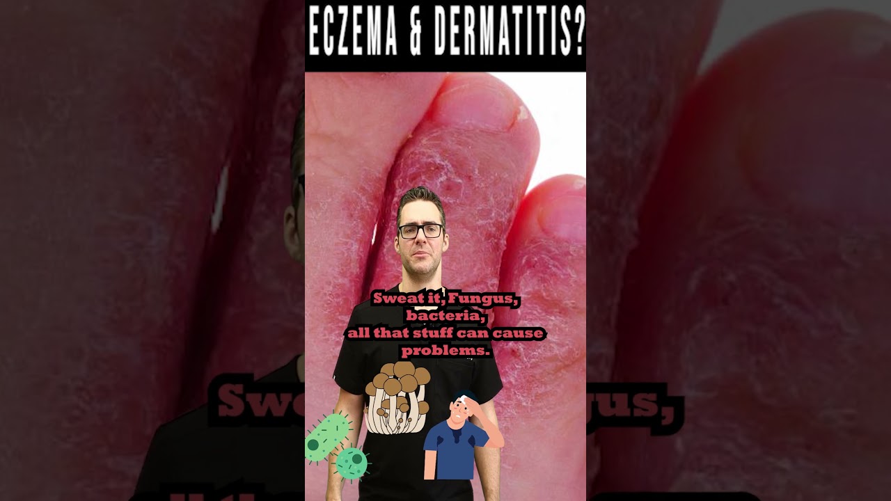 dry itchy skin or rash on feet or legs dermatitis eczema